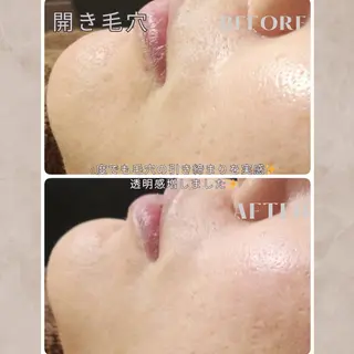 大橋 唯のエステ・リラクイメージ