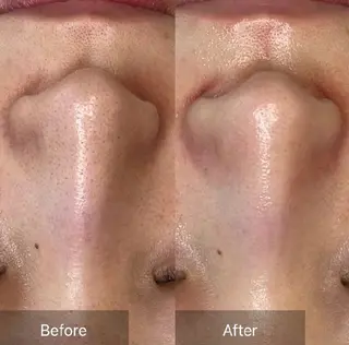 安川 陽向のエステ・リラクイメージ