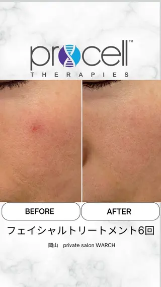 WARCH Marieのその他イメージ