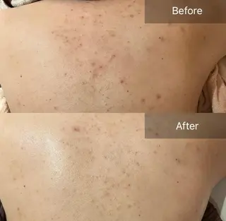 for woman所属・森 美優のエステ・リラクイメージ