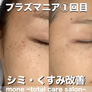 mone~total care salon~所属・mone (モーネ)のエステ・リラクイメージ