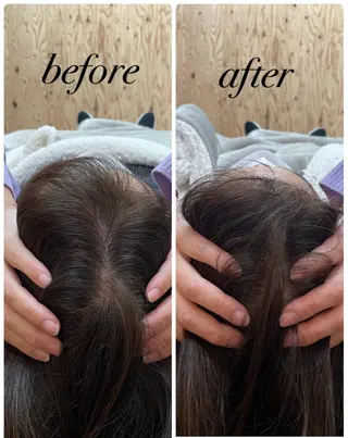 ate'所属・個室ドライヘッドスパ 🍃moriのエステ・リラクイメージ