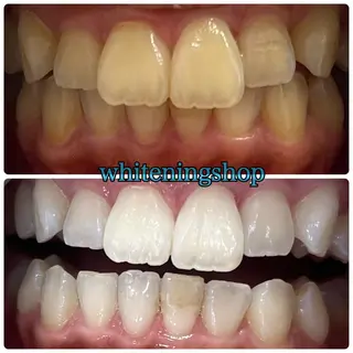 メンズ ホワイトニング ショップ千葉店のその他イメージ