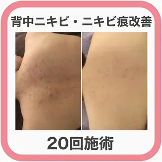 ミディアム カラー パーマ ヘアアレンジ メンズ キッズ ネイル マツエク・マツパ ニキビ・肌質改善専門 ♡人生が変わるサロンのエステ・リラクイメージ