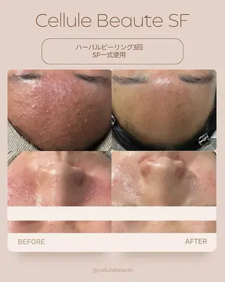 スキンケアサロン　デディア所属・米谷🎀 デディア恵比寿🪞✨のエステ・リラクイメージ