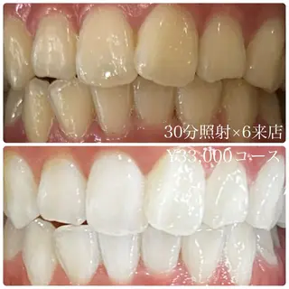 PLATINUM Beauty 横浜店所属・ホワイトニングルーム 横浜店のその他イメージ