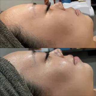 LiZA エステティックサロンのエステ・リラクイメージ