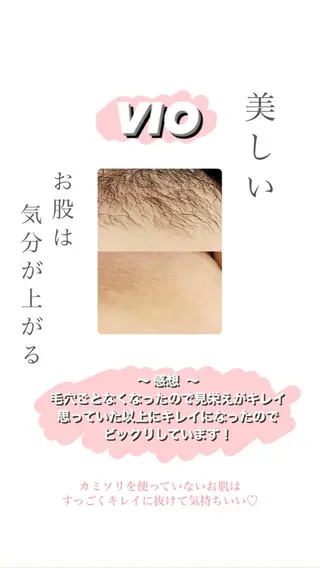 Hit. シュガーリング豊橋のエステ・リラクイメージ