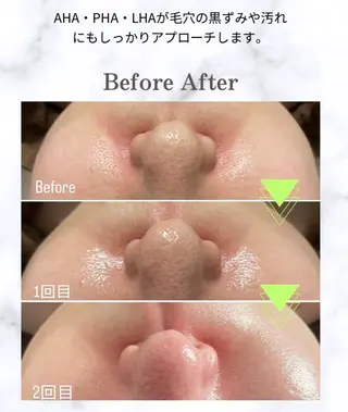 メンズ beauty salonnのエステ・リラクイメージ