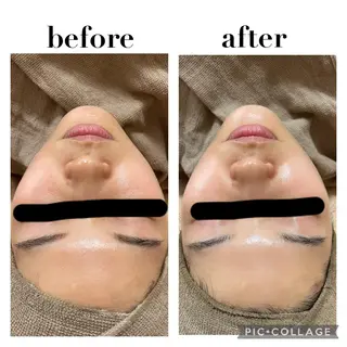 ECXIA ｴｸｼｱのエステ・リラクイメージ