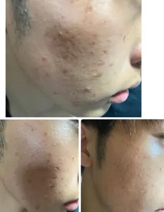 ARONA(アローナ)所属・ARONA ♡のエステ・リラクイメージ