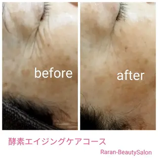 若返り 美肌   エステサロンららんのエステ・リラクイメージ