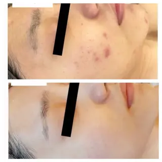 肌質改善エステRISMIN所属・肌質改善エステ RISMINのエステ・リラクイメージ