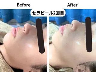 Ageing salon Be.所属・エイジングサロンビー EMIのエステ・リラクイメージ