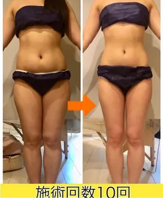 ショート カラー パーマ ヘアアレンジ メンズ キッズ ネイル マツエク・マツパ ‍痩身＆ボディ 結果出し🌟丹野のエステ・リラクイメージ