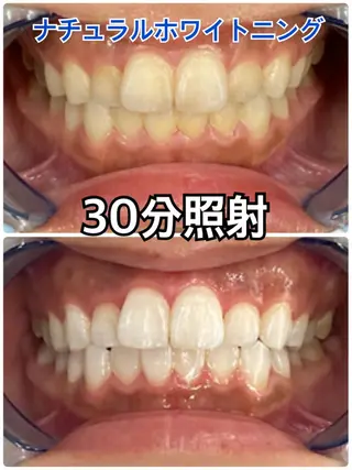 Platinum Beauty 四条烏丸店所属・吉田亮利 ホワイトニング専門店のその他イメージ