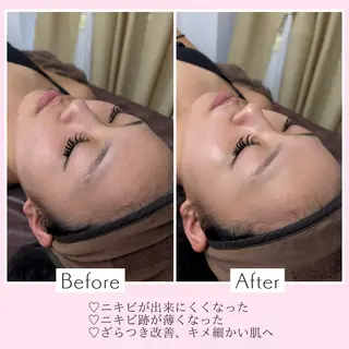 Mr.&Ms.脱毛 YUNAのその他イメージ