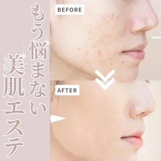 アイアンド ネイルデイのエステ・リラクイメージ