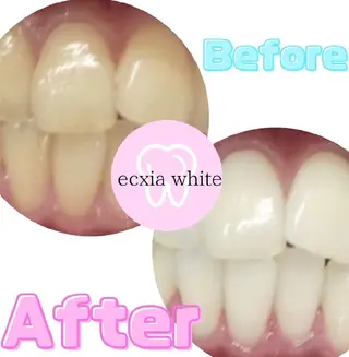 メンズ エクシアホワイトニング草津店所属・nanami -ホワイトニングのその他イメージ