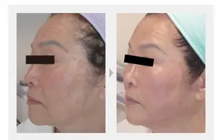 M. lisyelのエステ・リラクイメージ