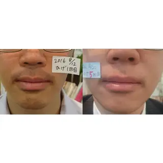 脱毛サロンPetit ange所属・Petit ange 綾瀬のエステ・リラクイメージ