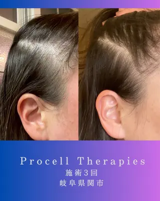 氣楽所属・松下 さゆりのエステ・リラクイメージ