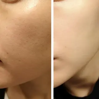 🅖🅤🅩🅔🅛 salonのエステ・リラクイメージ