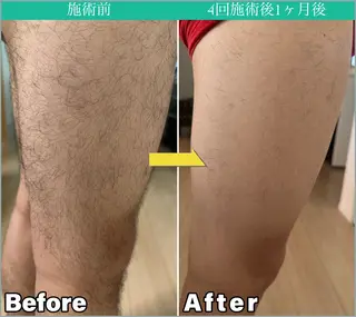 メンズ JONRY所属・JONRY （ジョンリー）のエステ・リラクイメージ