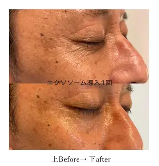 ﾌﾟﾗｲﾍﾞｰﾄｻﾛﾝ アンクチュール所属・UnCouture 〜アンクチュール〜のエステ・リラクイメージ