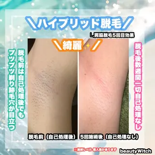 痩身/脱毛/ネイル HARUKAのエステ・リラクイメージ