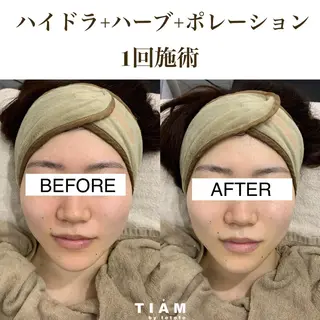 美肌サロンTIAM by tetoteのエステ・リラクイメージ