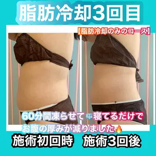 痩身/脱毛/ネイル HARUKAのエステ・リラクイメージ