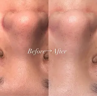 Babel Total Beauty所属・Babel haruのエステ・リラクイメージ