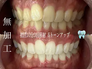 札幌ホワイトニング ラディアンス札幌駅店のその他イメージ