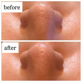 肌質改善専門 ハーブ /毛穴洗浄 リエイトのエステ・リラクイメージ