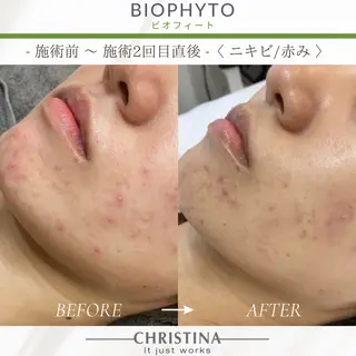 THE SALON -esme-のマツエク・マツパデザイン