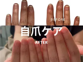 メンズ ネイル 爪ケア/深爪 自爪育成 🐰えむのネイルデザイン