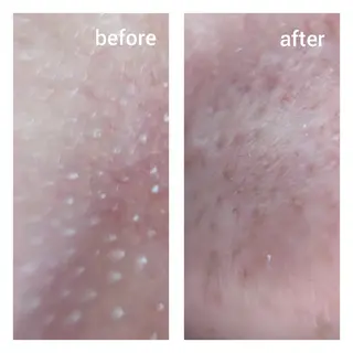 ビューティサロン Hananowaのその他イメージ