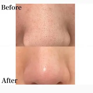 Eyelash salon MORE(モア)所属・安納 麻穂のエステ・リラクイメージ