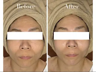 Avenir Brillant所属・松田 紗季のエステ・リラクイメージ