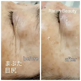 若返り 美肌   エステサロンららんのエステ・リラクイメージ