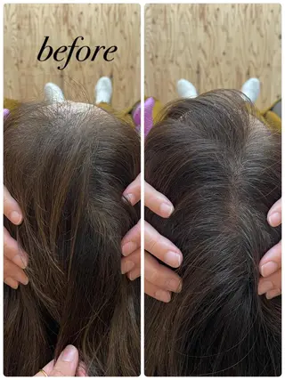 ate'所属・個室ドライヘッドスパ 🍃moriのエステ・リラクイメージ