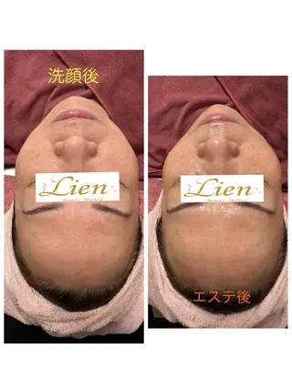 Lien オーナー　山口智嘉のエステ・リラクイメージ