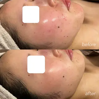 越野 Tulipe栄店のエステ・リラクイメージ