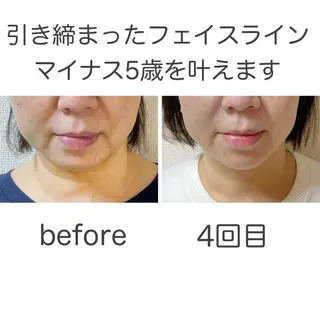 小顔矯正サロン　クレール所属・小顔矯正専門サロン クレールのエステ・リラクイメージ