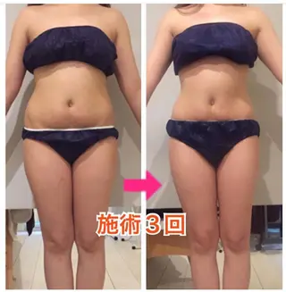 ロング カラー パーマ ヘアアレンジ メンズ キッズ ネイル マツエク・マツパ ‍痩身＆ボディ 結果出し🌟丹野のエステ・リラクイメージ