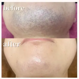 脱毛エステサロンViViPirina所属・軽部 歩のエステ・リラクイメージ