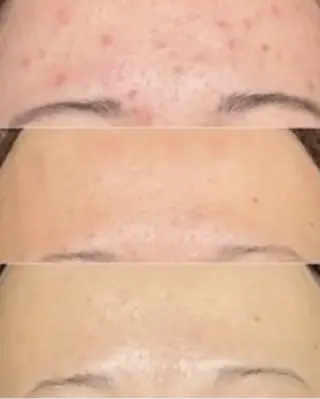 肌質改善専門サロンAte国分寺店所属・Ate Rikaのエステ・リラクイメージ