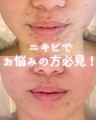 private beauty salon Lilby所属・リルビー 肌育・肌質改善サロンのその他イメージ