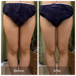 【元に戻らない】 小顔&部分痩せのその他イメージ